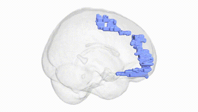 Full Brain White