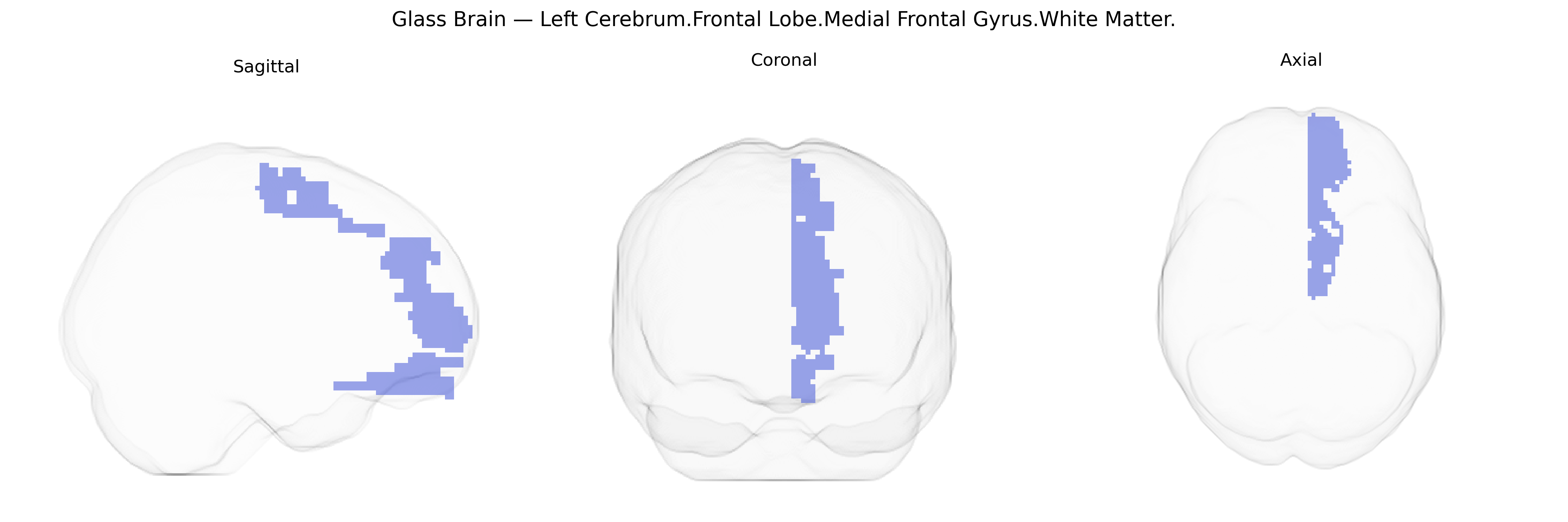 Triplanar Ghost Brain
