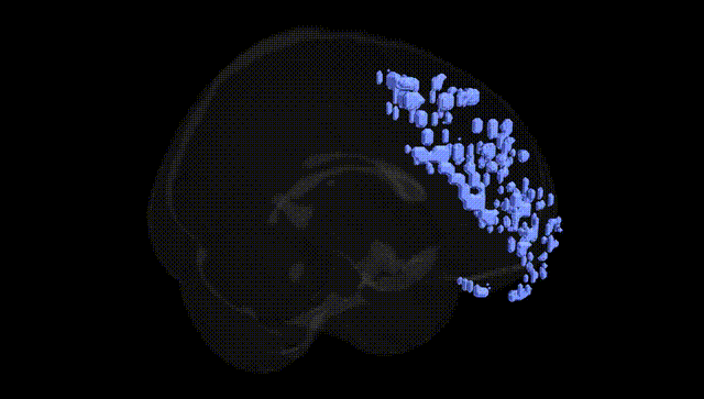 Full Brain Black
