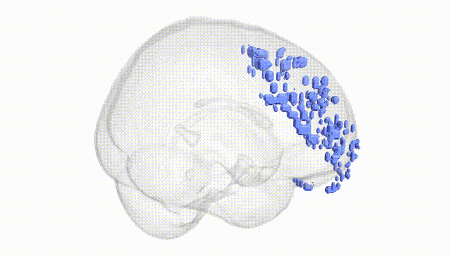 Full Brain White