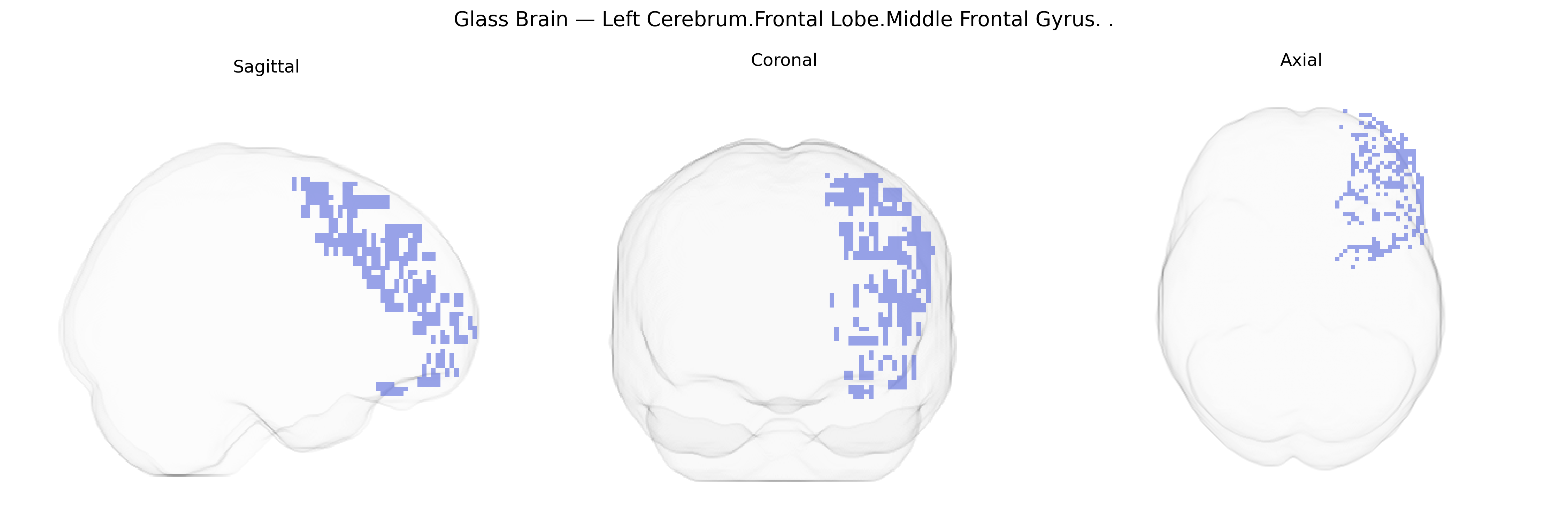 Triplanar Ghost Brain