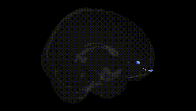Full Brain Black