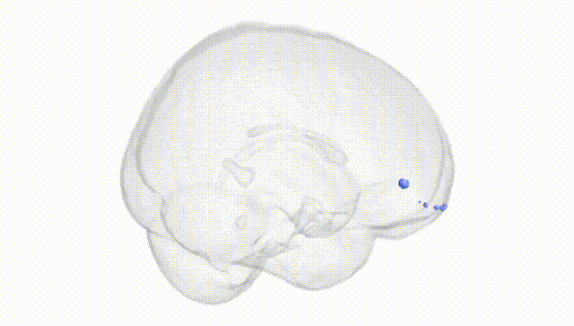 Full Brain White