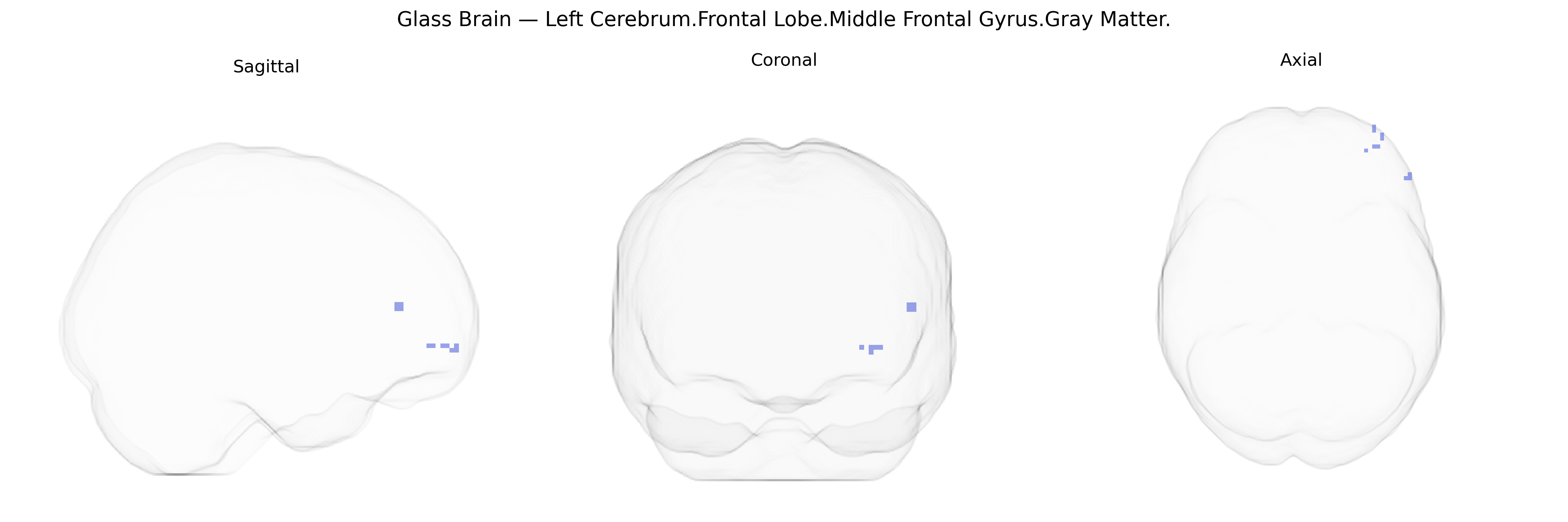 Triplanar Ghost Brain