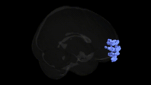 Full Brain Black