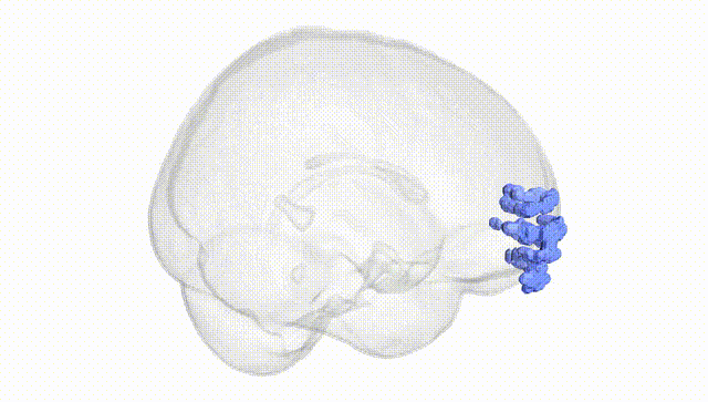 Full Brain White