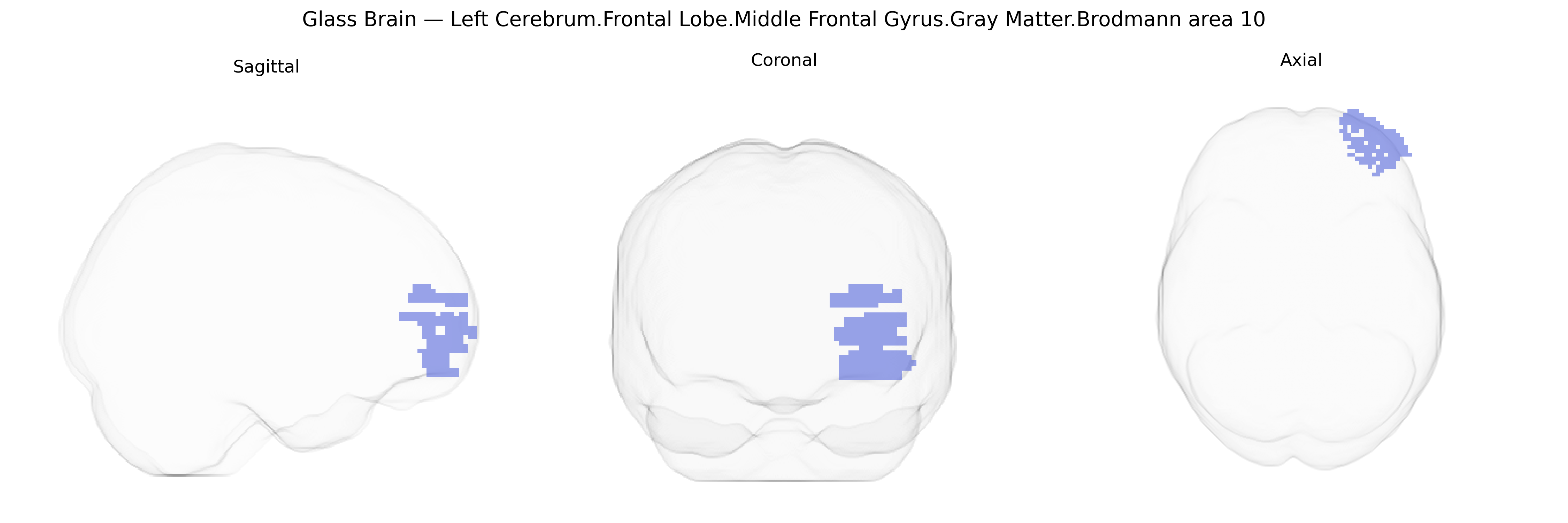Triplanar Ghost Brain