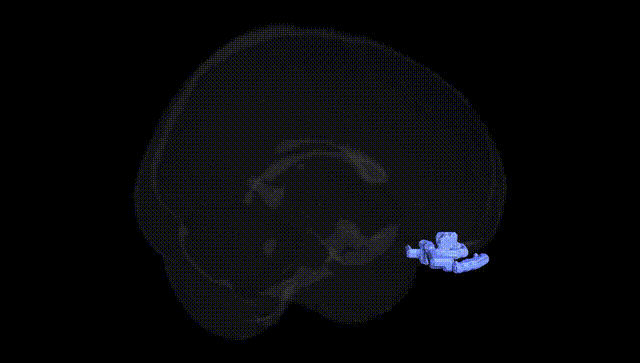 Full Brain Black