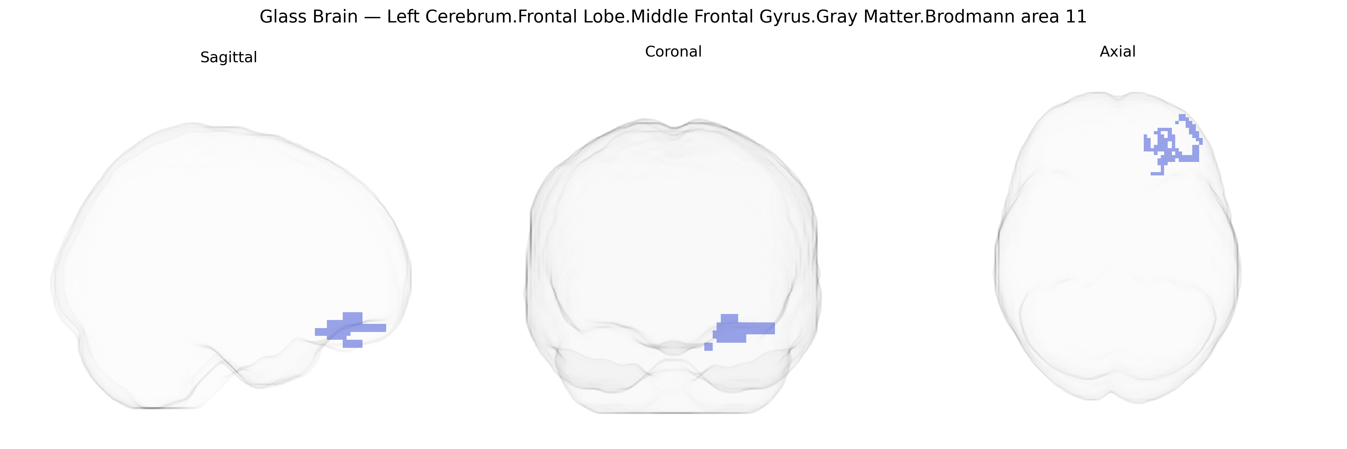 Triplanar Ghost Brain