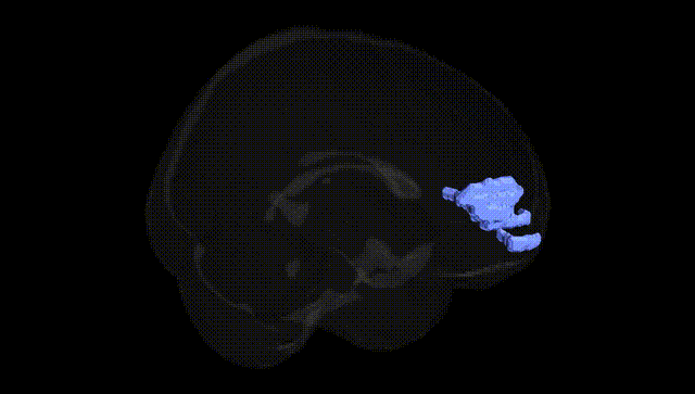 Full Brain Black