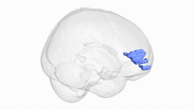 Full Brain White