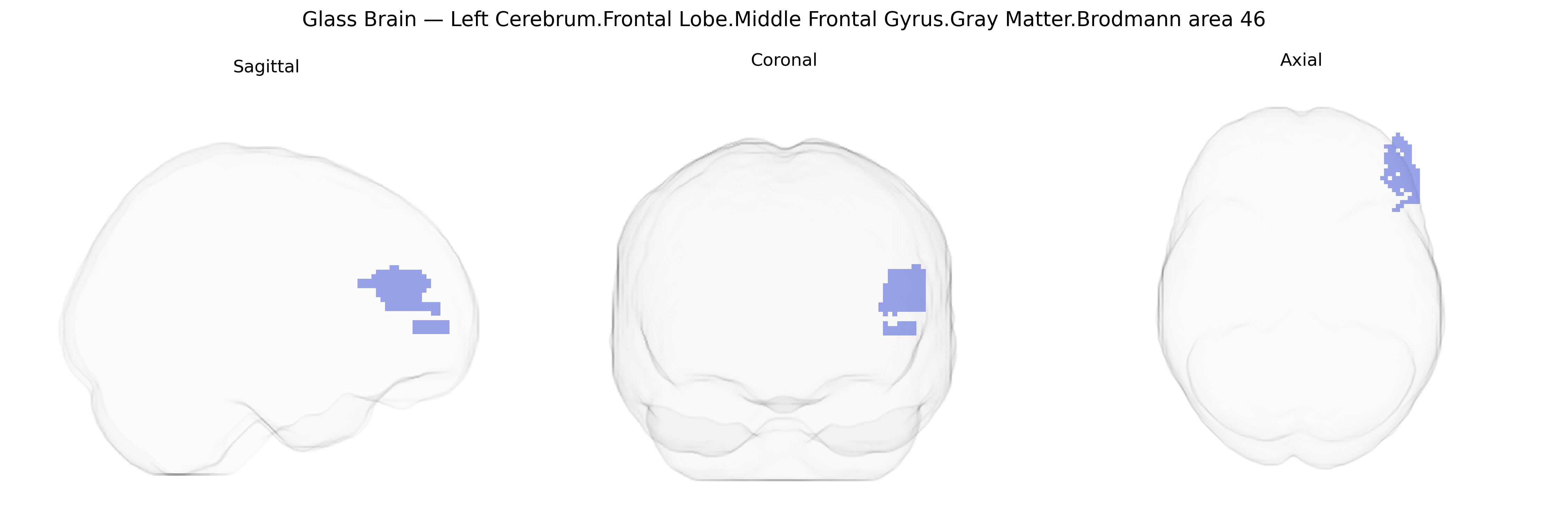 Triplanar Ghost Brain