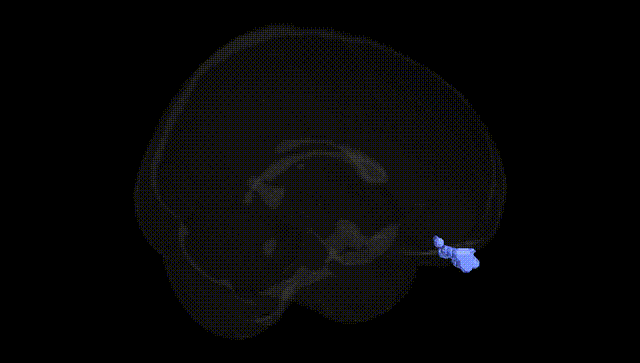 Full Brain Black