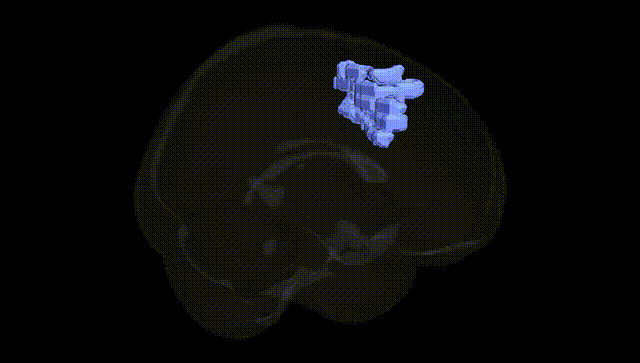 Full Brain Black
