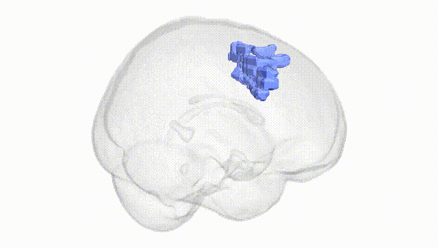 Full Brain White