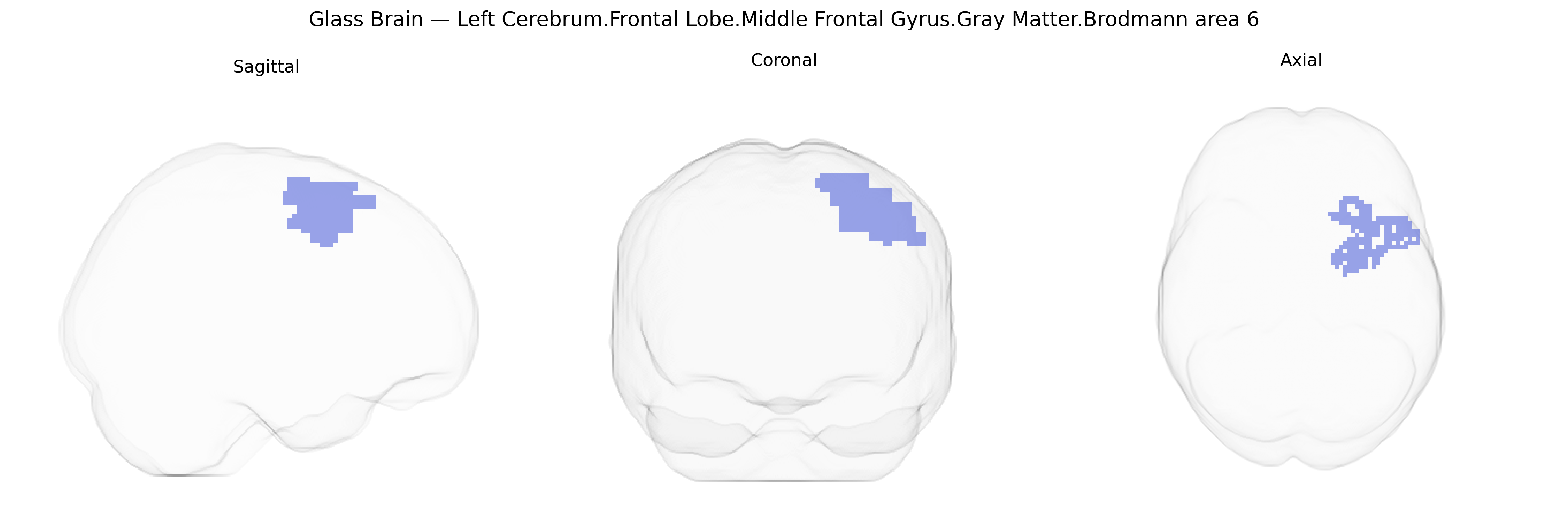 Triplanar Ghost Brain