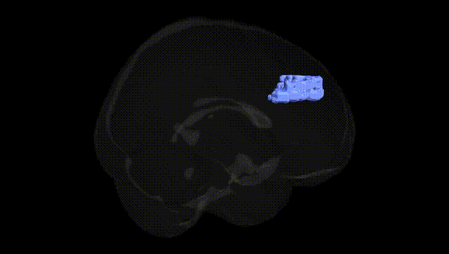 Full Brain Black