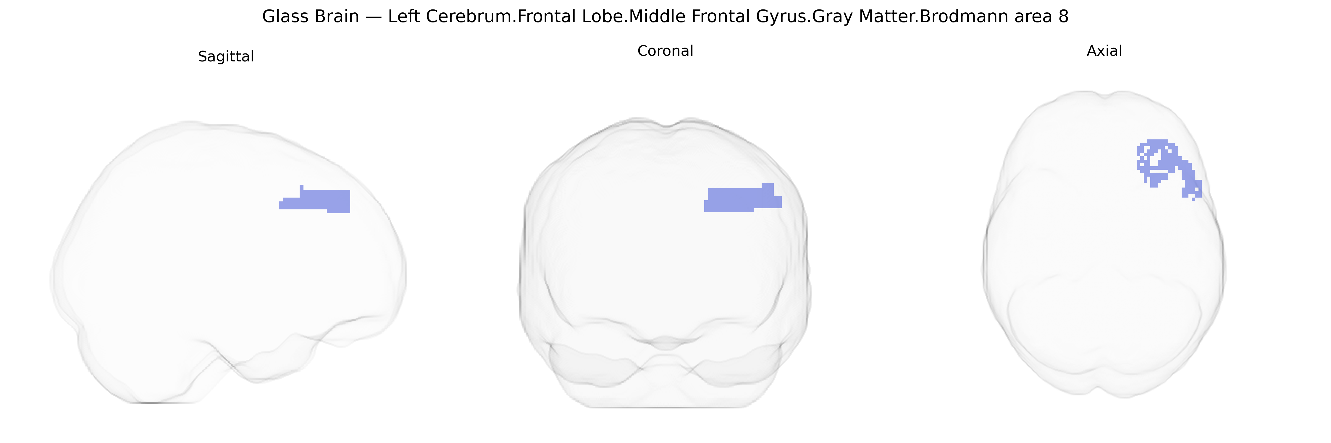 Triplanar Ghost Brain