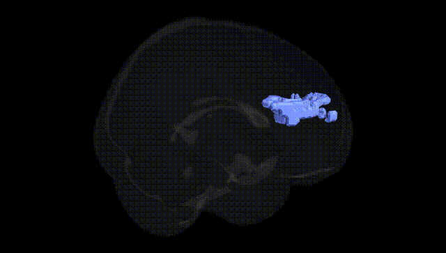 Full Brain Black