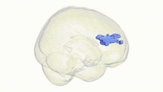 Full Brain White