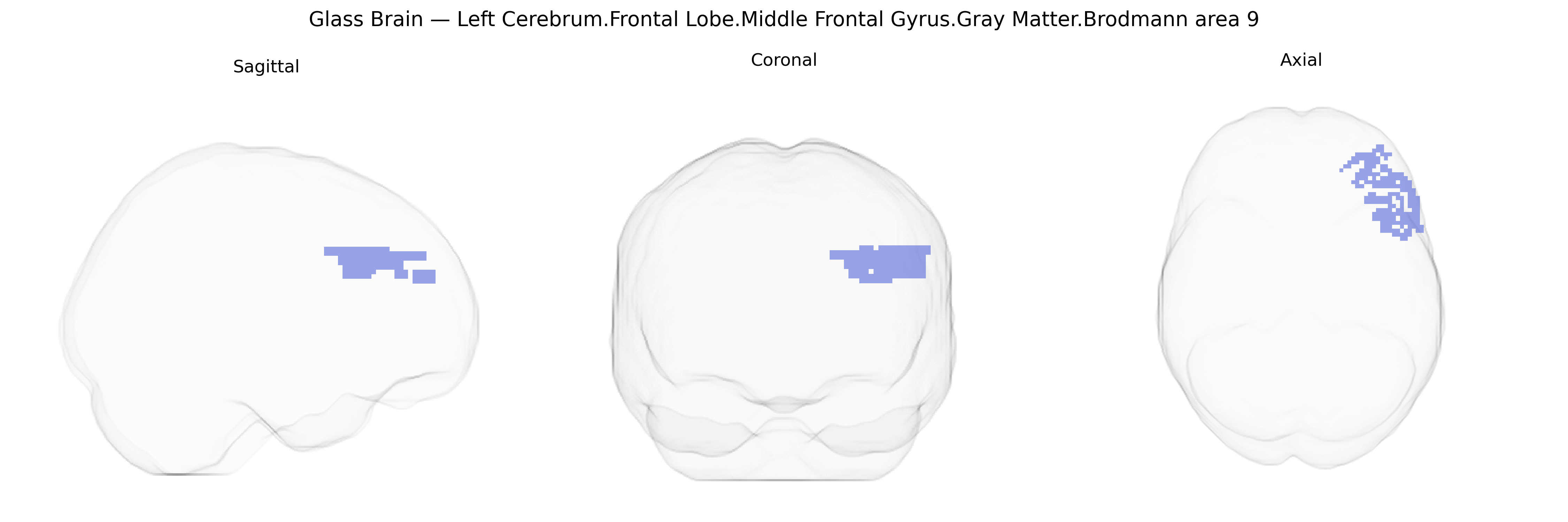 Triplanar Ghost Brain