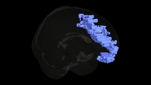 Full Brain Black
