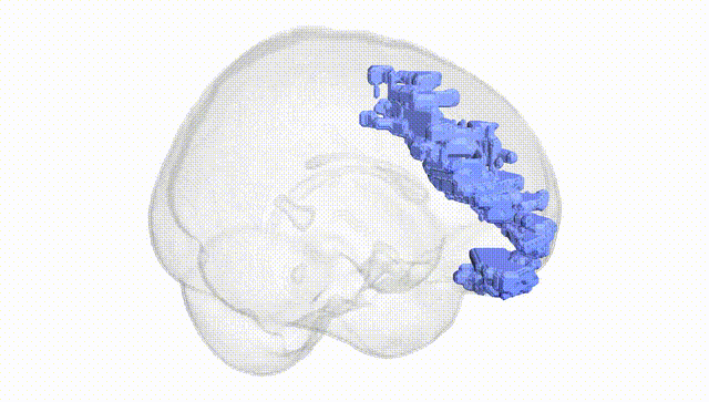 Full Brain White