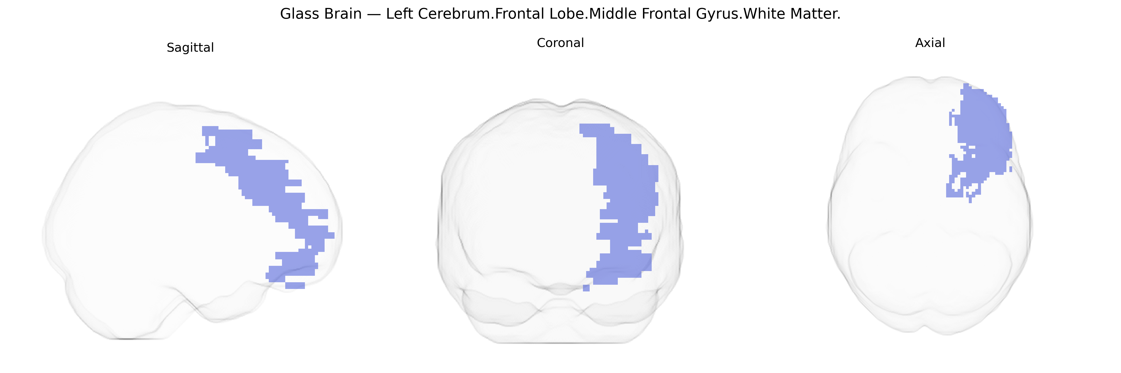 Triplanar Ghost Brain