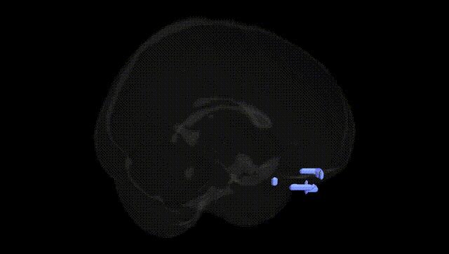 Full Brain Black