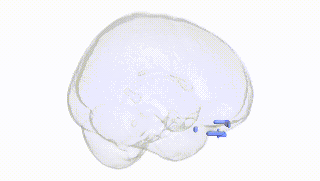 Full Brain White