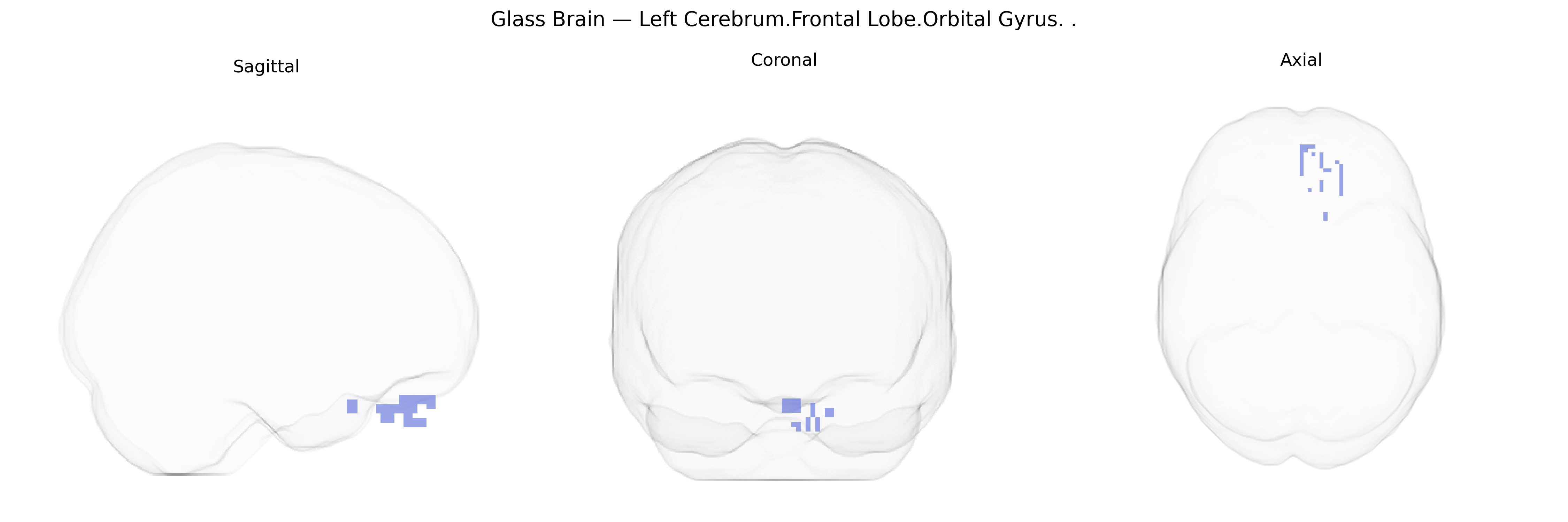 Triplanar Ghost Brain
