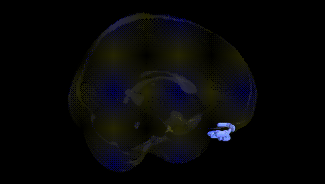 Full Brain Black