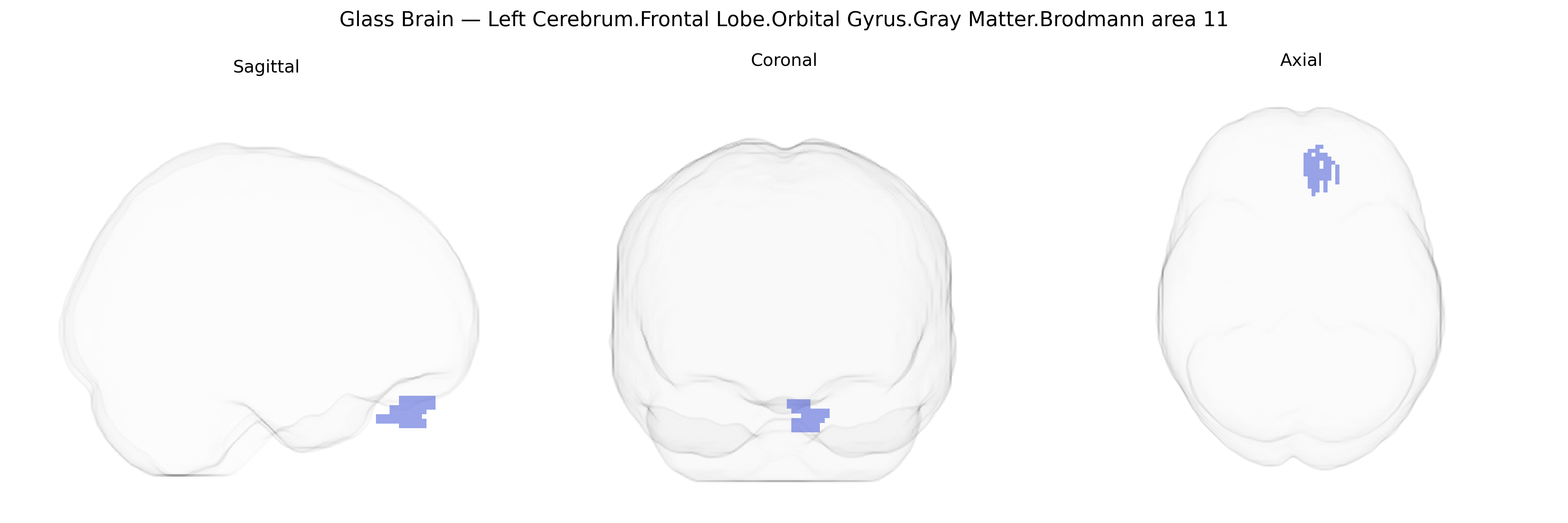 Triplanar Ghost Brain