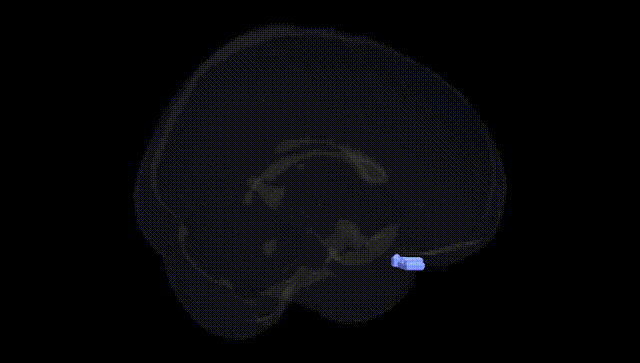Full Brain Black