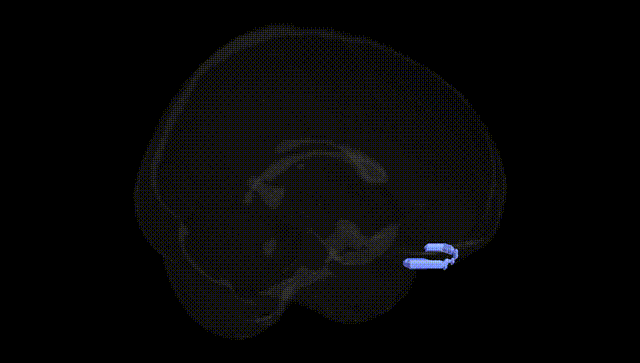 Full Brain Black