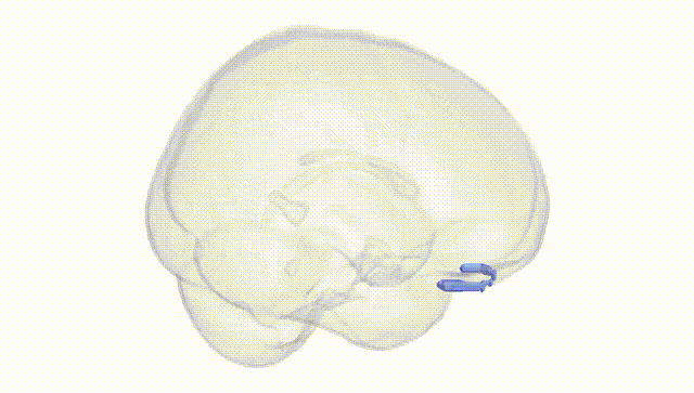 Full Brain White