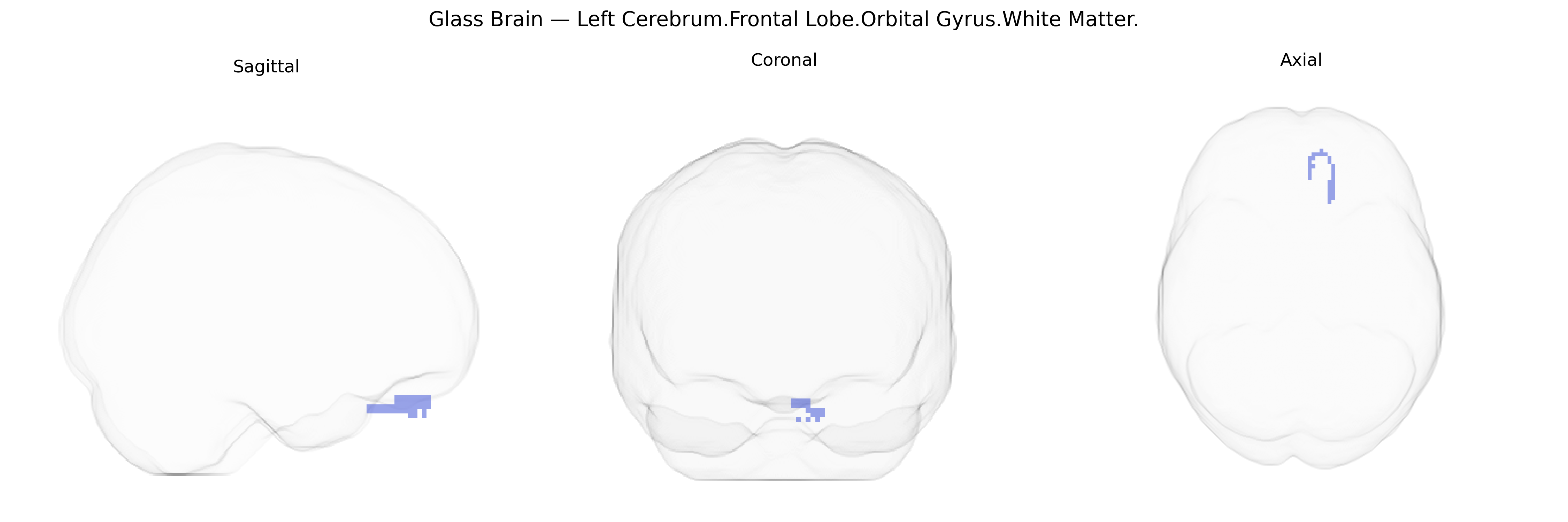Triplanar Ghost Brain