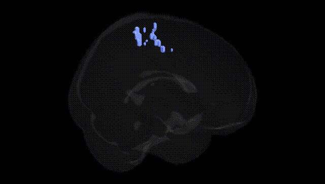 Full Brain Black