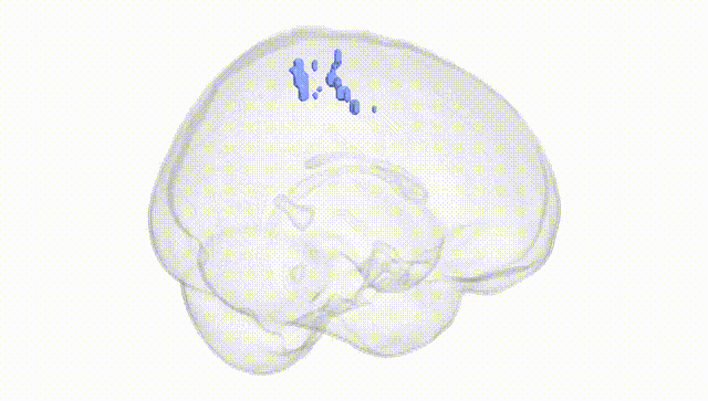 Full Brain White