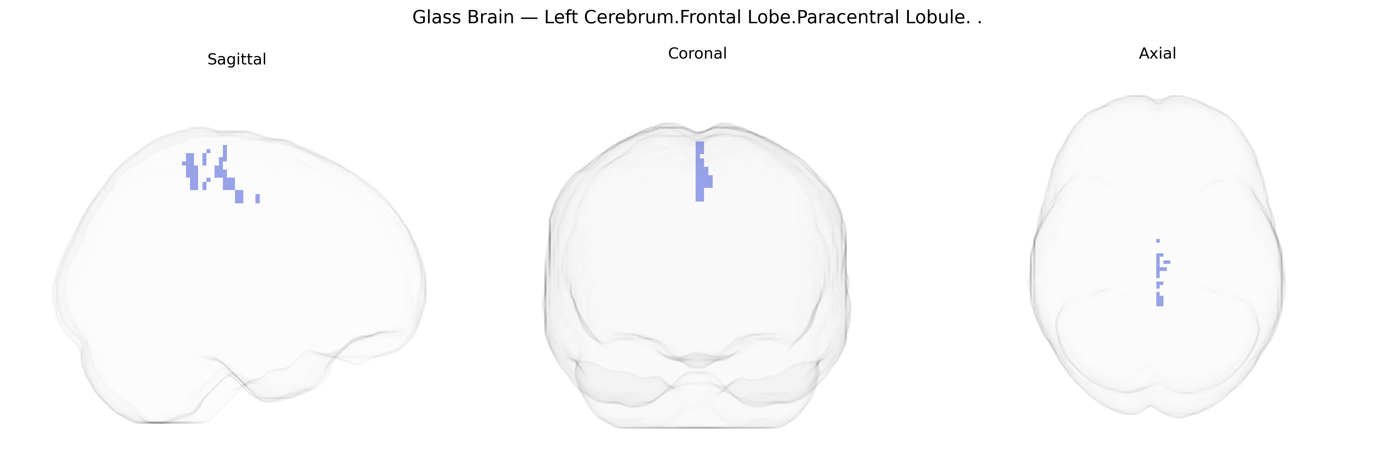 Triplanar Ghost Brain