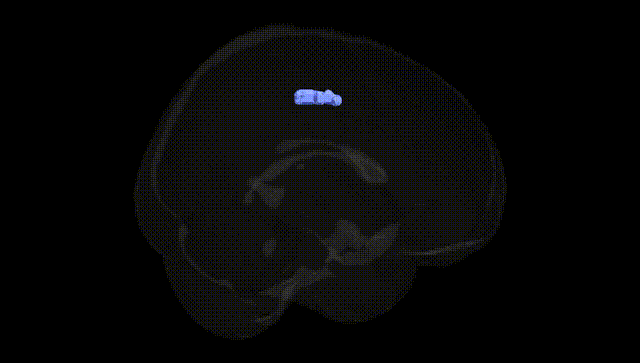 Full Brain Black