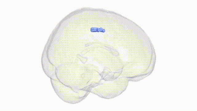 Full Brain White