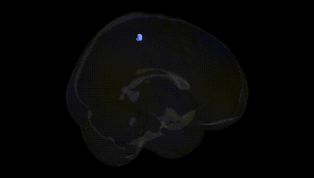 Full Brain Black
