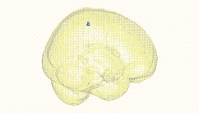 Full Brain White
