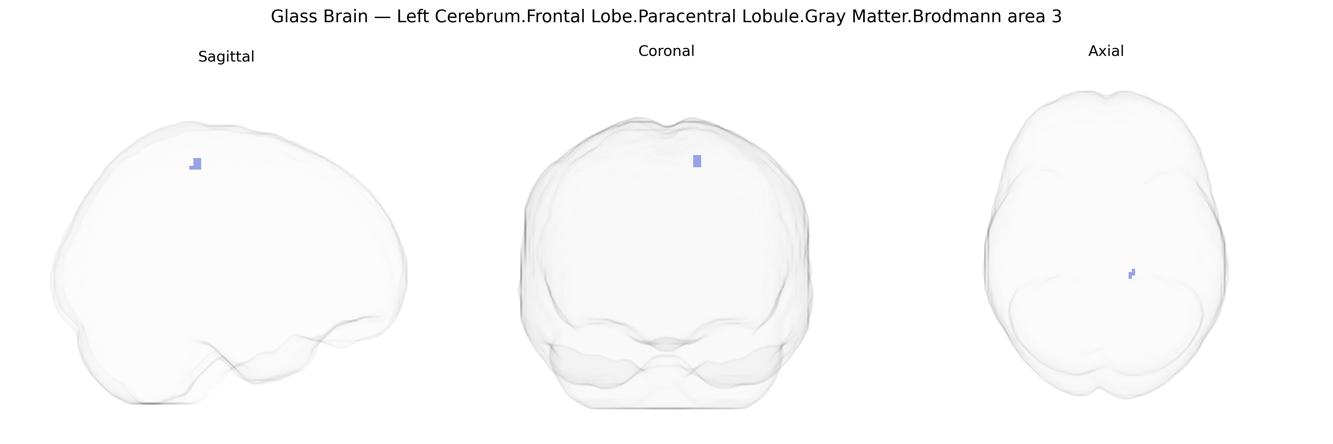 Triplanar Ghost Brain