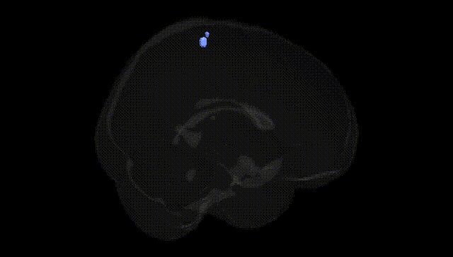 Full Brain Black