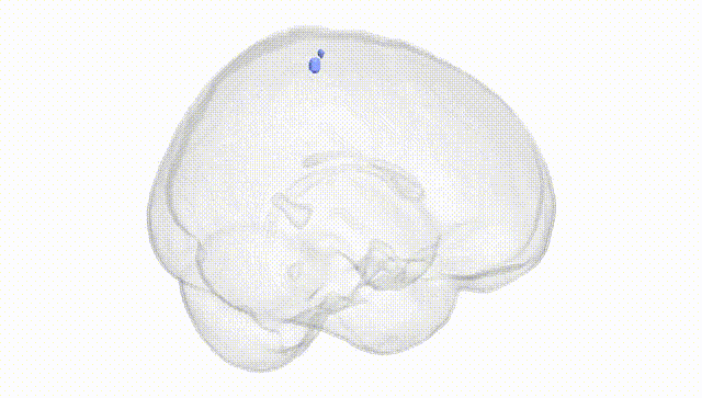 Full Brain White