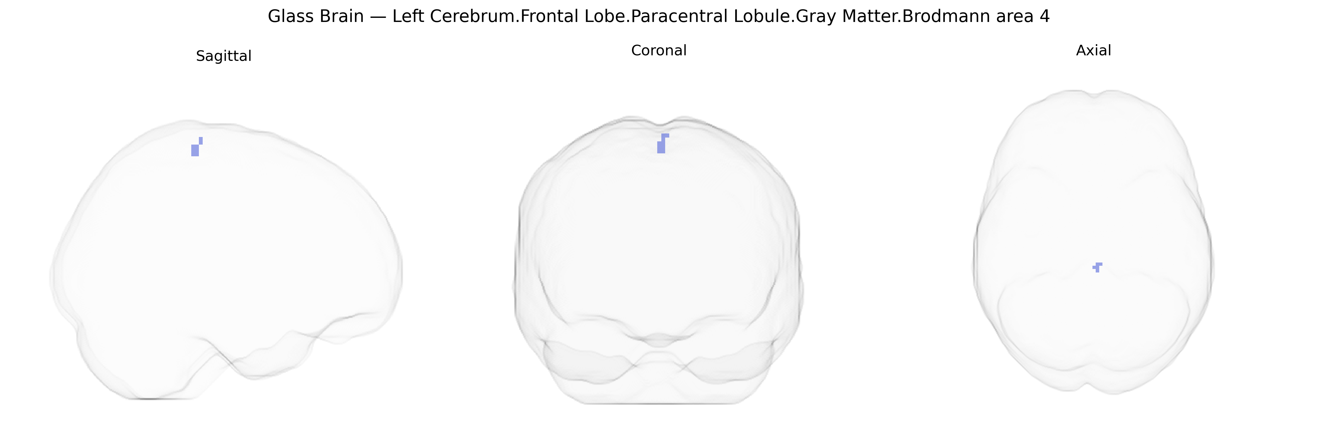 Triplanar Ghost Brain