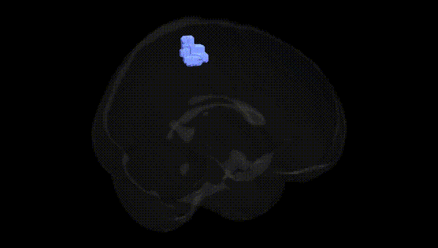 Full Brain Black