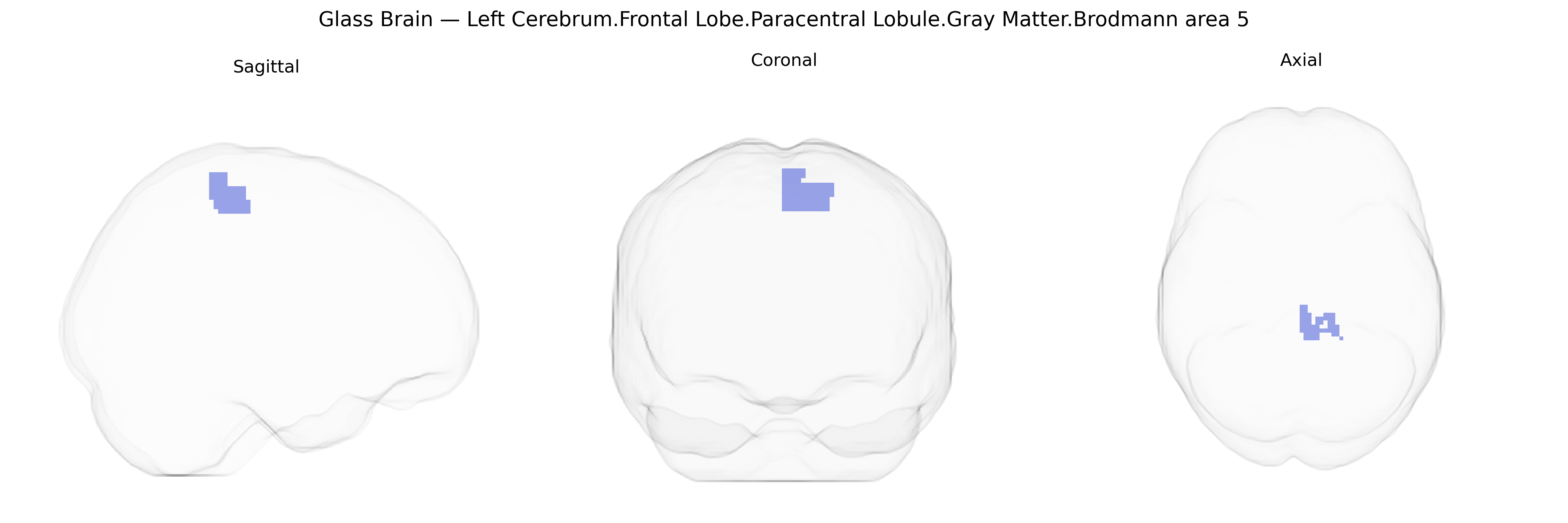 Triplanar Ghost Brain